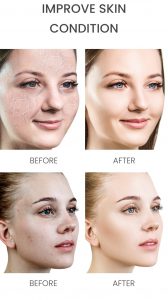 5D Hyaluronic acid hydrating face serum 10