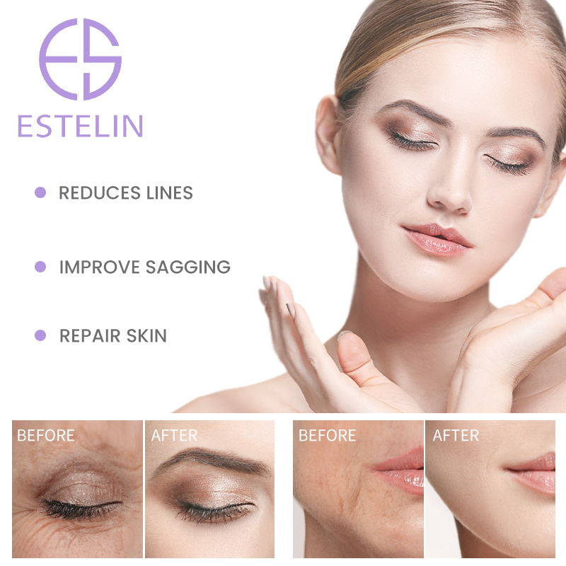 Retinol Aanti aging face serum 1