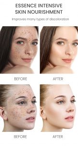 Rosehip& Niacinamide spots fading face serum 9