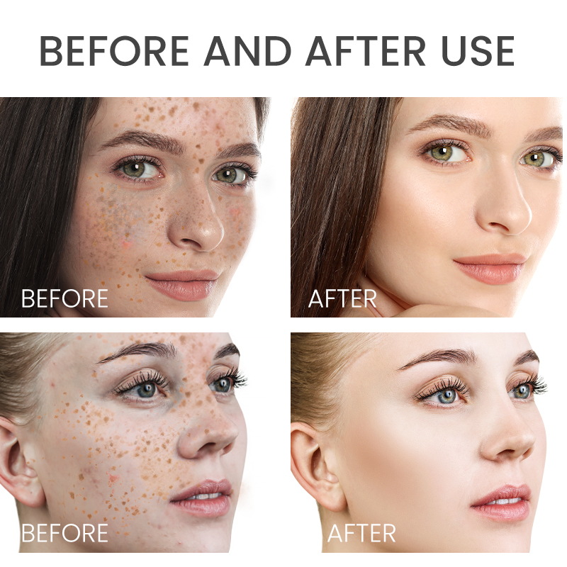 Rosehip& Niacinamide spots fading face serum