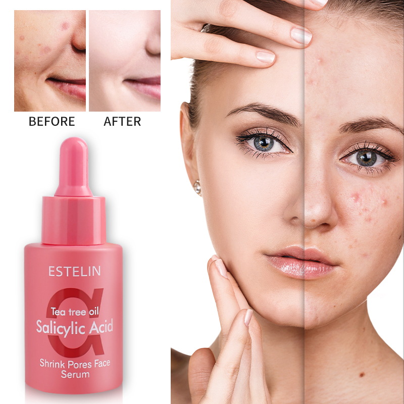 Salicylic acid&Tea tree oil shrink pores face serum 3