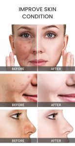 Salicylic acid&Tea tree oil shrink pores face serum 9 Salicylic acid&Tea tree oil shrink pores face serum 9