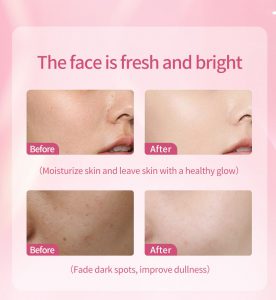 Alpha arbutin & niacinamide whitening cream 14 Alpha arbutin & niacinamide whitening cream 14