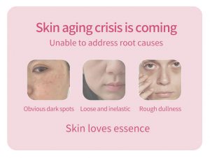 Alpha arbutin & niacinamide whitening cream 4 Alpha arbutin & niacinamide whitening cream 4