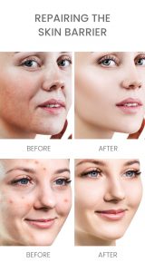 Ceramide B5 repairing face serum 10 Ceramide B5 repairing face serum 10