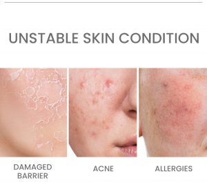 Ceramide B5 repairing face serum 3