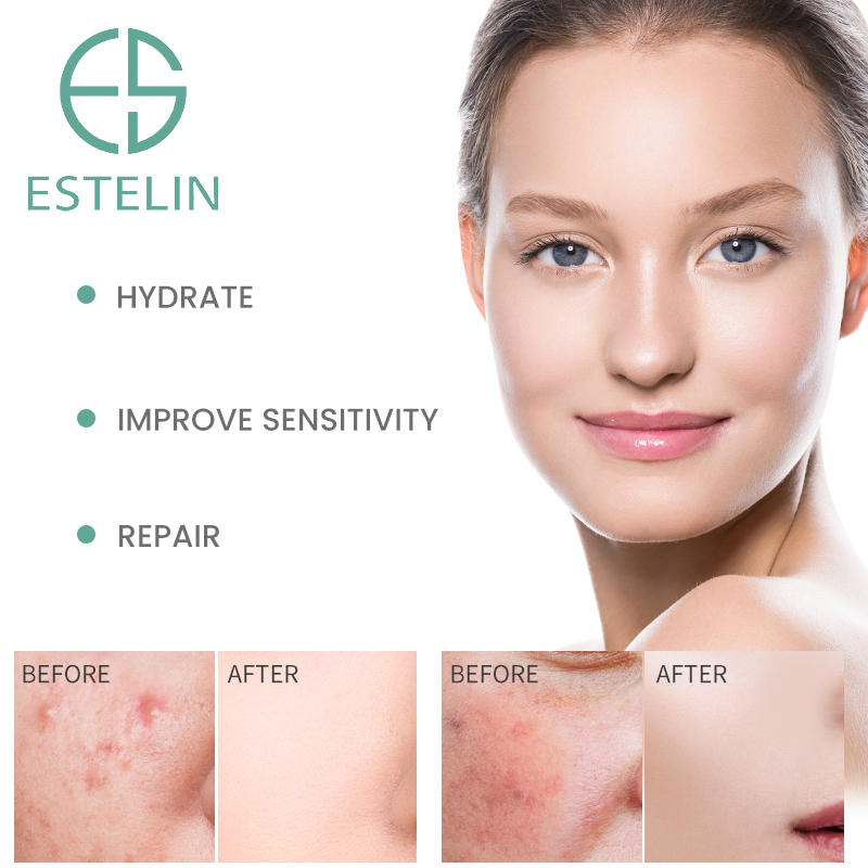 Ceramide B5 repairing face serum 3