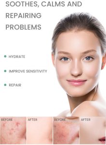 Ceramide B5 repairing face serum 7