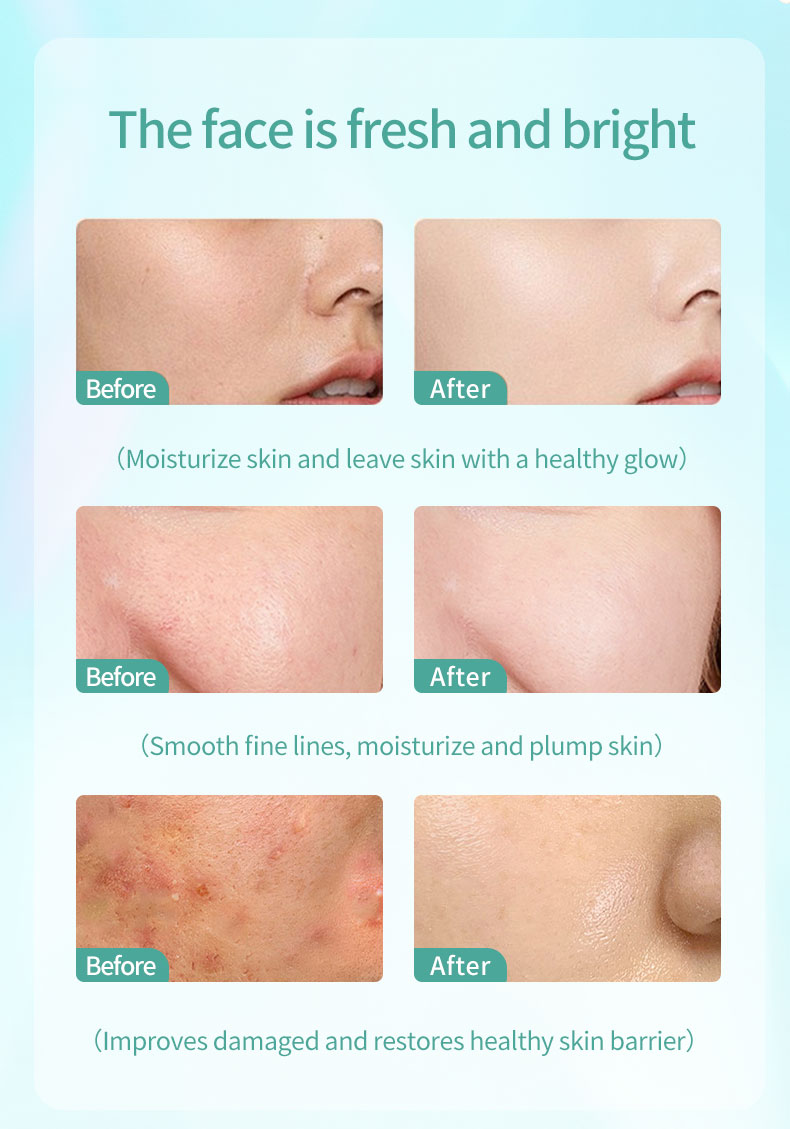 Ceramide & centella asiatica repair cream 14 Ceramide & centella asiatica repair cream 14