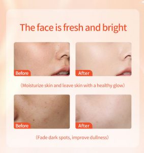 Turmeric & Vitamin c brightening cream 14 Turmeric & Vitamin c brightening cream 14